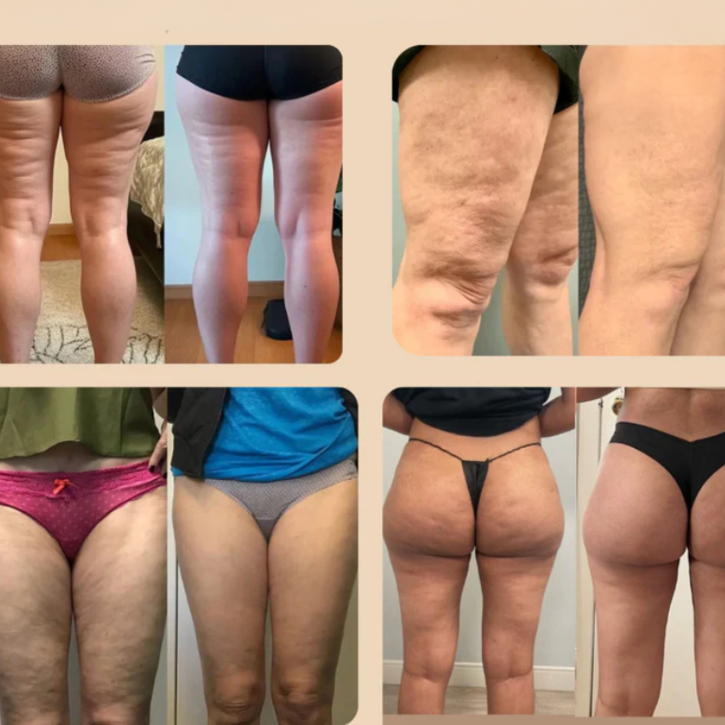 3D Legginsy Antycellulitowe